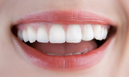 Cách tốt nhất để làm trắng răng của bạn là gì? 14