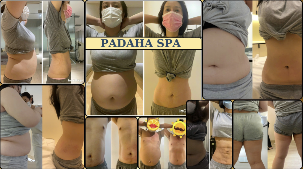 Massage Giảm Béo Tại Padaha Spa Có Thật Sự Chất Lượng? 2