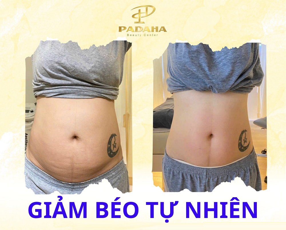 Padaha tự hào là địa chỉ giảm béo uy tín hàng đầu với nhiều ưu điểm nổi bật