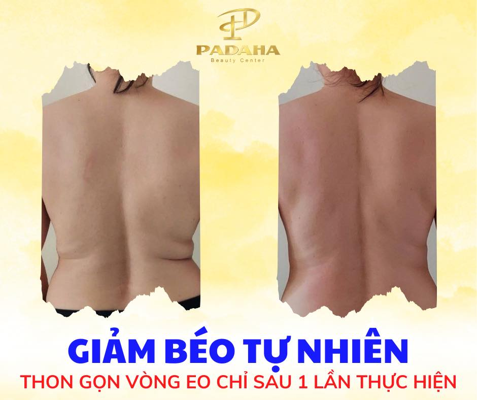 Khám Phá Phương Pháp Massage Giảm Béo Độc Quyền Tại Padaha 6
